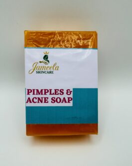 Pimples & Acne Soap